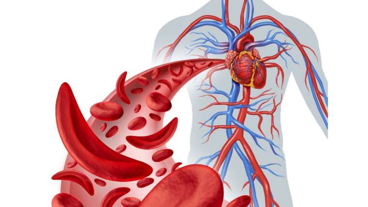 Tônico de cúrcuma para melhorar a circulação sanguínea: melhore sua saúde cardiovascular